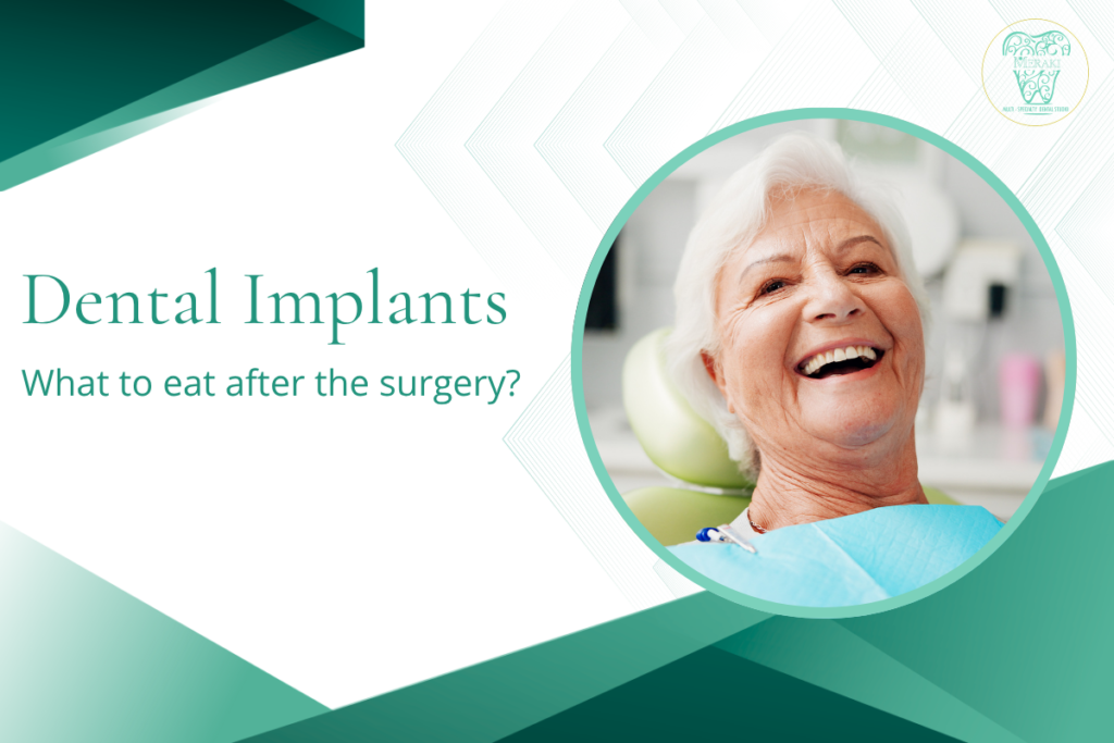 What To Eat After Dental Implant Surgery