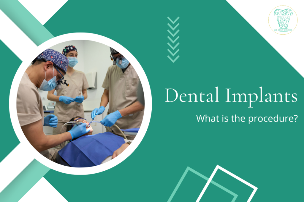 What is Dental Implant Procedure