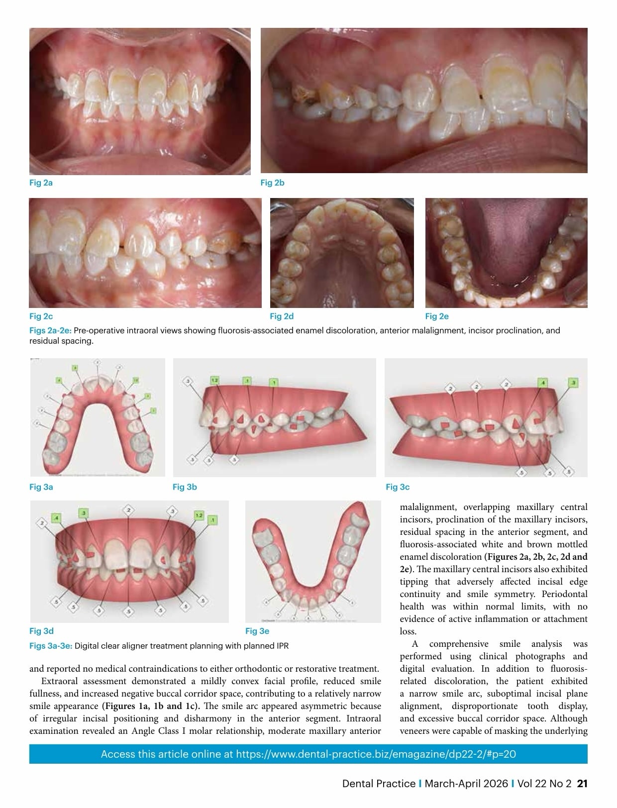 Case-2-2